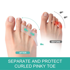 Hyggear Little Toe [Tailor's Bunion] Corrector